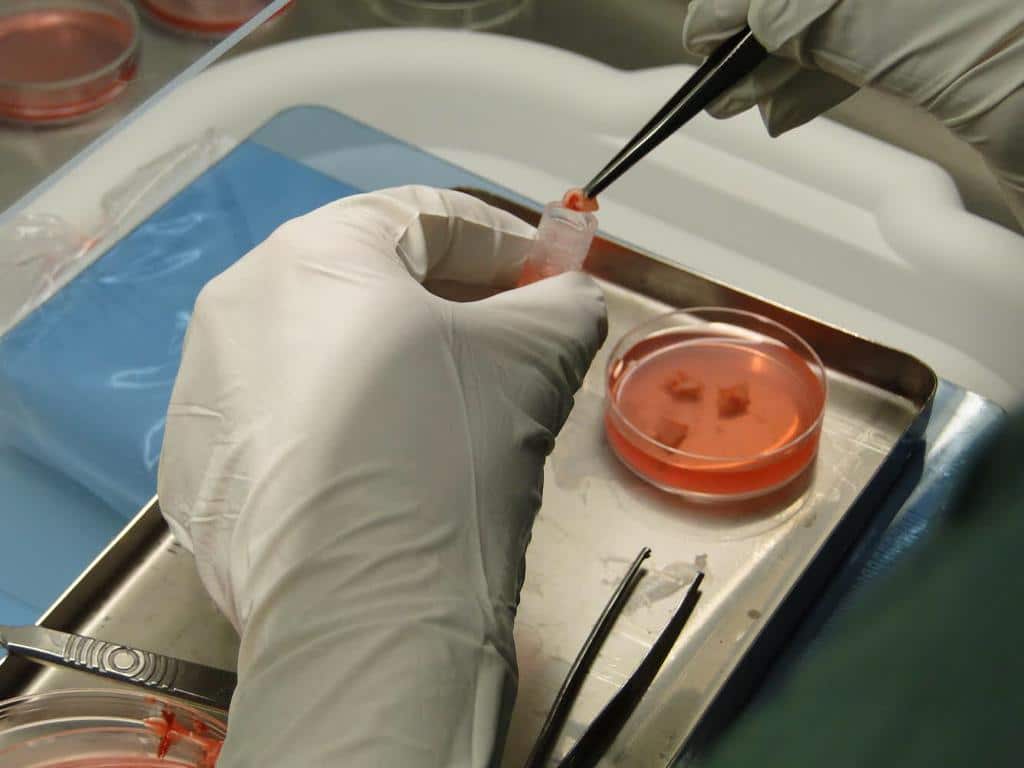 Ovarian tissue prepared for cryopreservation